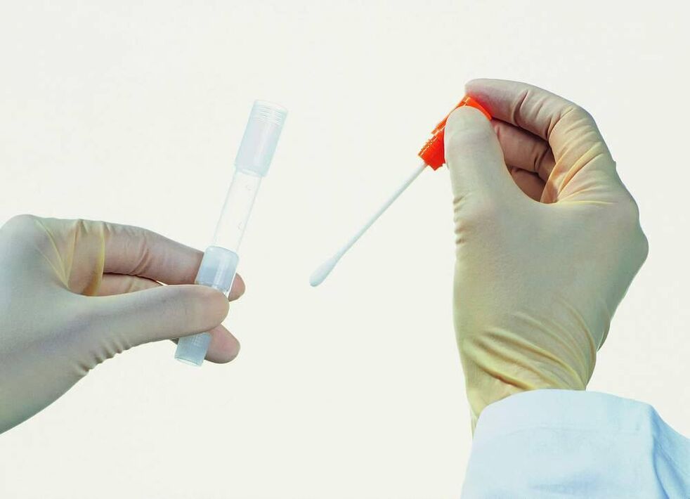 Recolección de pruebas para detectar prostatitis crónica
